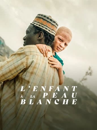 The Boy with White Skin