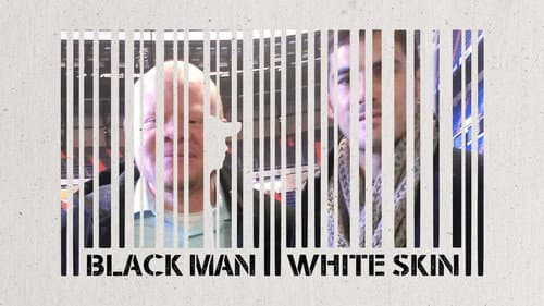 Black Man White Skin still