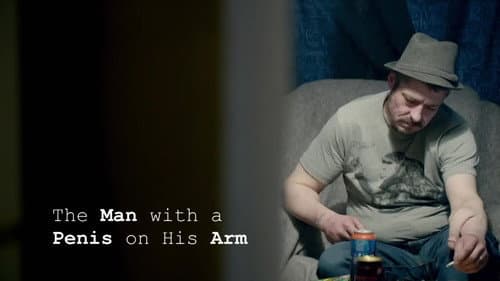 The Man With a Penis on His Arm still