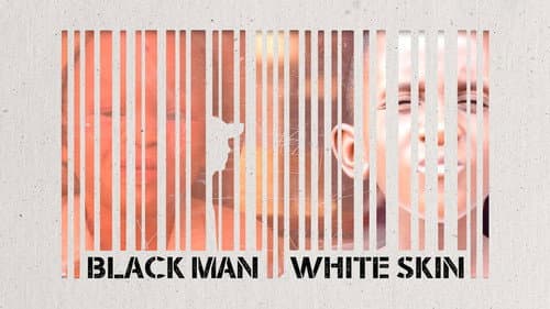 Black Man White Skin still