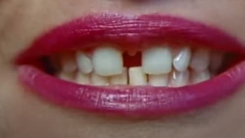 Gap-Toothed Women still