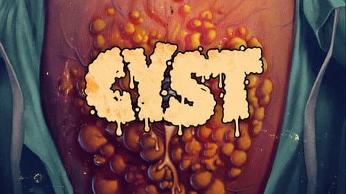 Cyst still