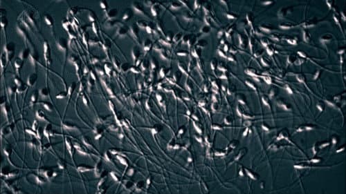 The Great Sperm Race still