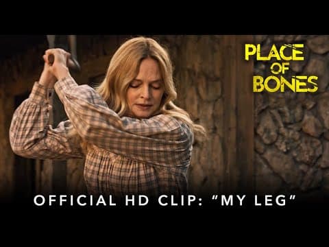 "My Leg"